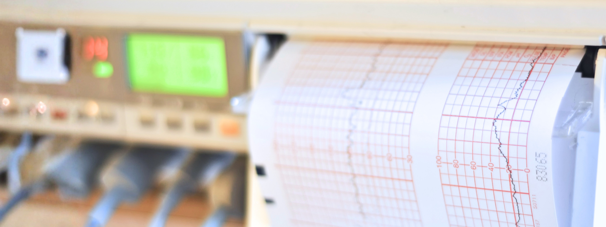 ECG test