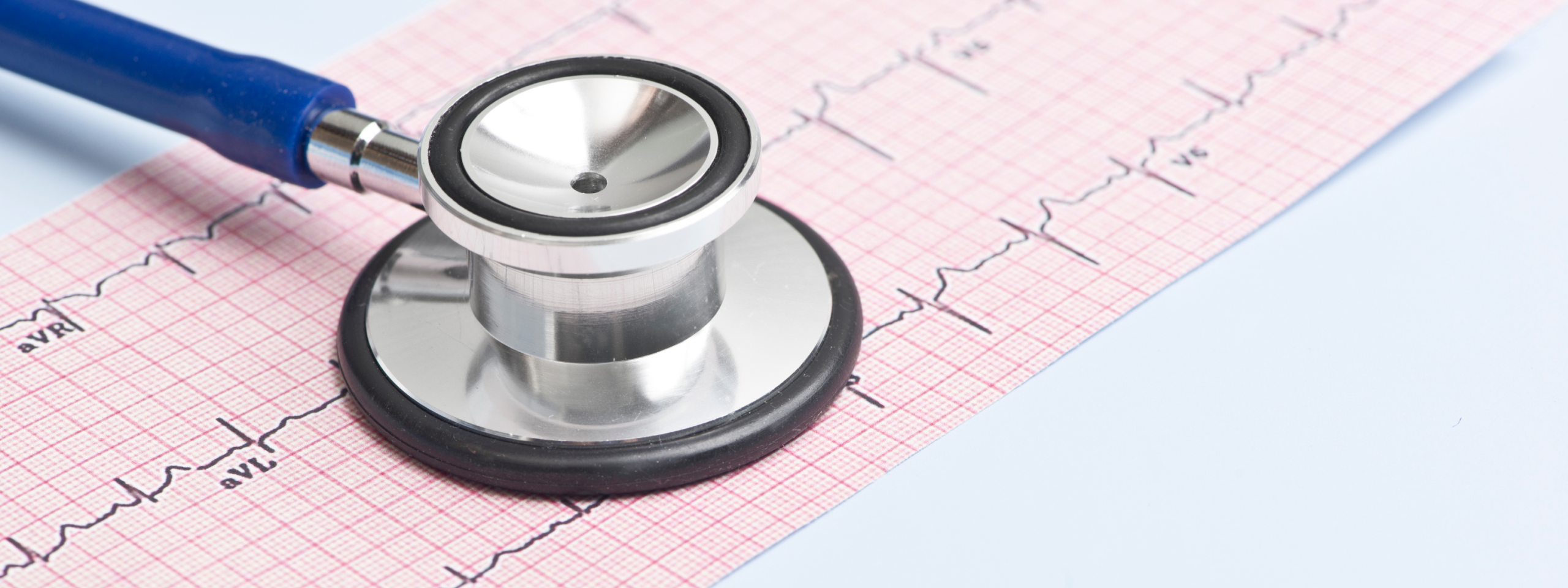 ECG